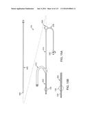 Systems And Methods For Treating A Carotid Artery diagram and image