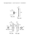 Systems And Methods For Treating A Carotid Artery diagram and image