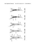 Systems And Methods For Treating A Carotid Artery diagram and image