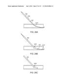 Systems And Methods For Treating A Carotid Artery diagram and image