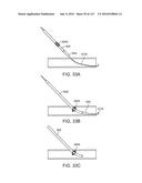 Systems And Methods For Treating A Carotid Artery diagram and image