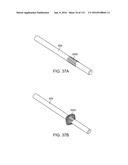 Systems And Methods For Treating A Carotid Artery diagram and image