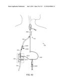 Systems And Methods For Treating A Carotid Artery diagram and image