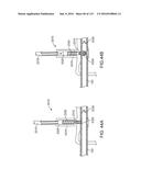 Systems And Methods For Treating A Carotid Artery diagram and image