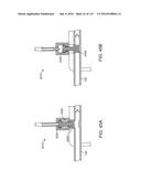 Systems And Methods For Treating A Carotid Artery diagram and image