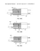 Systems And Methods For Treating A Carotid Artery diagram and image