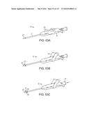 Systems And Methods For Treating A Carotid Artery diagram and image