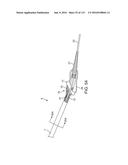 Systems And Methods For Treating A Carotid Artery diagram and image