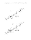 Systems And Methods For Treating A Carotid Artery diagram and image