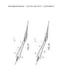 Systems And Methods For Treating A Carotid Artery diagram and image