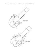 Systems And Methods For Treating A Carotid Artery diagram and image