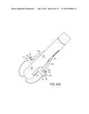 Systems And Methods For Treating A Carotid Artery diagram and image