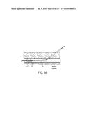 Systems And Methods For Treating A Carotid Artery diagram and image