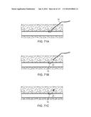 Systems And Methods For Treating A Carotid Artery diagram and image