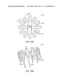 Systems And Methods For Treating A Carotid Artery diagram and image