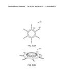 Systems And Methods For Treating A Carotid Artery diagram and image