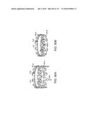 Systems And Methods For Treating A Carotid Artery diagram and image