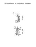 Systems And Methods For Treating A Carotid Artery diagram and image