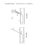 Systems And Methods For Treating A Carotid Artery diagram and image