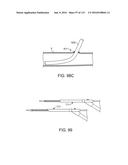 Systems And Methods For Treating A Carotid Artery diagram and image