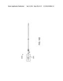 Systems And Methods For Treating A Carotid Artery diagram and image