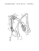 ADJUSTABLE CERVICAL COLLAR diagram and image