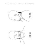 ADJUSTABLE CERVICAL COLLAR diagram and image