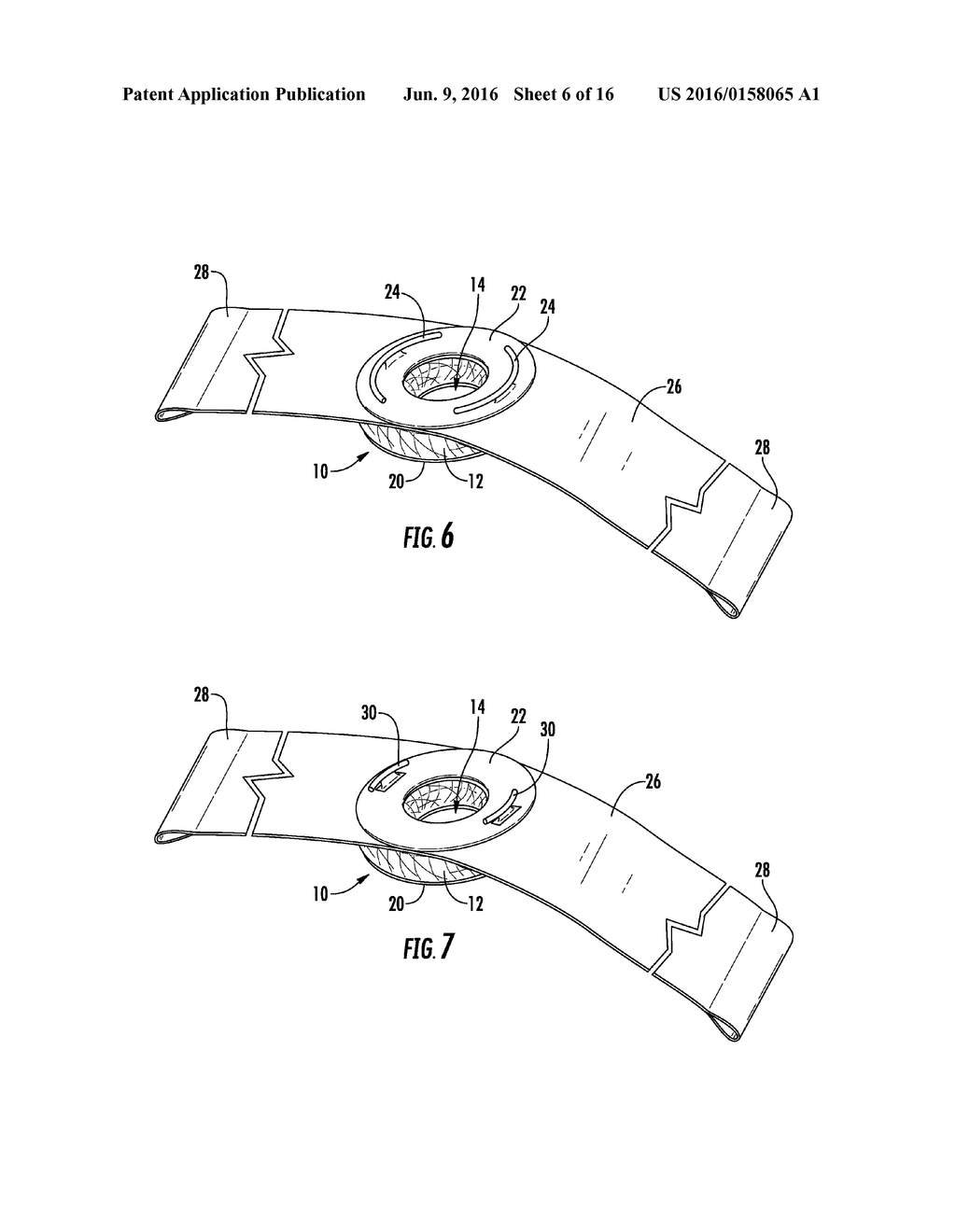 RING COMPRESSION BANDAGE - diagram, schematic, and image 07