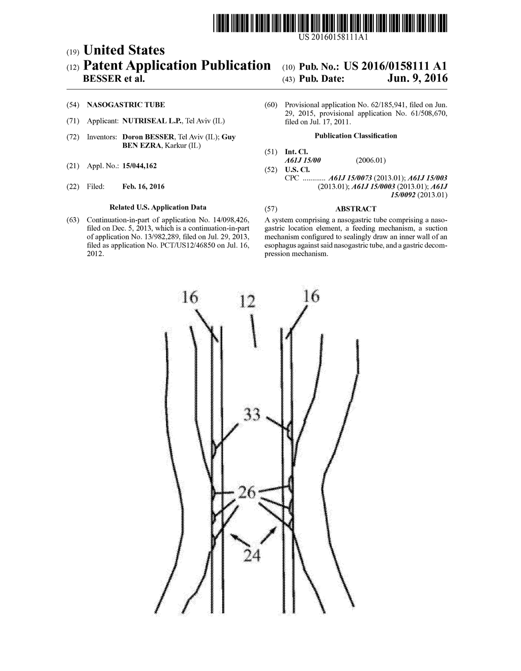 NASOGASTRIC TUBE - diagram, schematic, and image 01