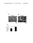 NOVEL USE FOR PAI-1 INHIBITOR diagram and image