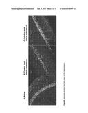 REDUCTION OF EPILEPTIC SEIZURES diagram and image