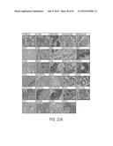 HUMAN APPLICATION OF ENGINEERED CHIMERIC ANTIGEN RECEPTOR (CAR) T-CELLS diagram and image