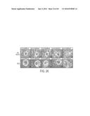 HUMAN APPLICATION OF ENGINEERED CHIMERIC ANTIGEN RECEPTOR (CAR) T-CELLS diagram and image