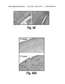 METHODS AND COMPOSITIONS FOR CNS DELIVERY OF IDURONATE-2-SULFATASE diagram and image