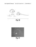 METHODS AND COMPOSITIONS FOR CNS DELIVERY OF IDURONATE-2-SULFATASE diagram and image