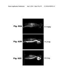 METHODS AND COMPOSITIONS FOR CNS DELIVERY OF IDURONATE-2-SULFATASE diagram and image