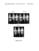 Messenger RNA Therapy for Treatment of Articular Disease diagram and image