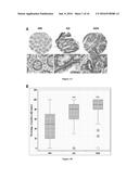 Anti-Claudin 1 Antibodies for Use in the Treatment of Colorectal Cancer diagram and image