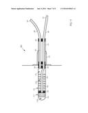 DEVICES AND METHODS FOR CLEANING CONTAMINATED BODY CAVITIES diagram and image