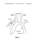 SKIN INTERFACE DEVICE FOR CARDIAC ASSIST DEVICE diagram and image