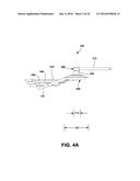 SKIN INTERFACE DEVICE FOR CARDIAC ASSIST DEVICE diagram and image