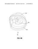 SKIN INTERFACE DEVICE FOR CARDIAC ASSIST DEVICE diagram and image