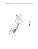 SKIN INTERFACE DEVICE FOR CARDIAC ASSIST DEVICE diagram and image