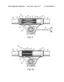 DIALYSIS VALVE AND METHOD diagram and image