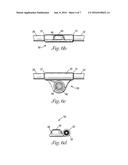 DIALYSIS VALVE AND METHOD diagram and image