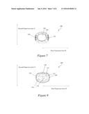 AUTOMATIC INJECTION DEVICES HAVING OVERMOLDED GRIPPING SURFACES diagram and image