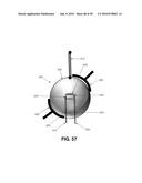 SYSTEM FOR DETECTING AND REMOVING A GAS BUBBLE FROM A VASCULAR INFUSION     LINE diagram and image