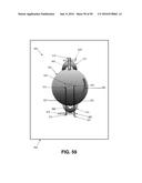 SYSTEM FOR DETECTING AND REMOVING A GAS BUBBLE FROM A VASCULAR INFUSION     LINE diagram and image