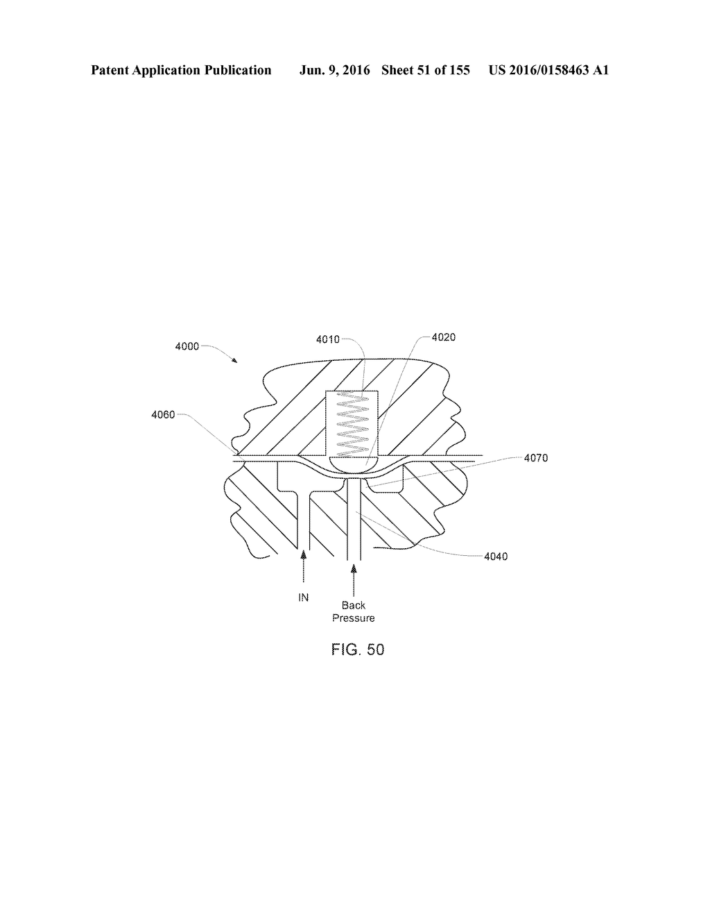 Adhesive and Peripheral Systems and Methods for Medical Devices - diagram, schematic, and image 52