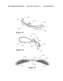 ASYMMETRICAL NASAL DELIVERY ELEMENTS AND FITTINGS FOR NASAL INTERFACES diagram and image